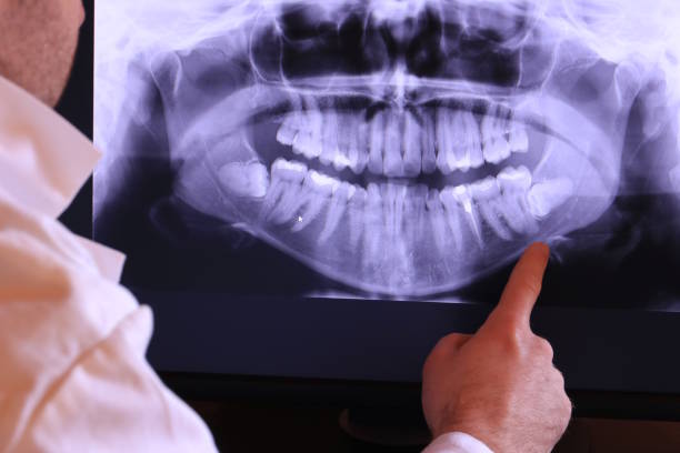 Best Emergency Gum Pain Relief  in Nassau Village Ratliff, FL